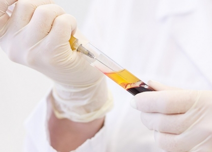 Nowoczesne zabiegi – synergia nauki i natury – osocze bogatopłytkowe