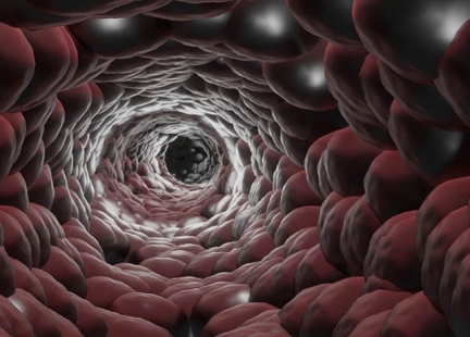 Olbrzymiokomórkowe zapalenie tętnic