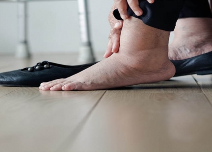 Obrzęk limfatyczny (limfodemia)