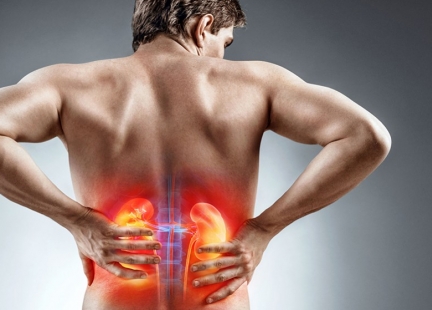 Co wywołuje kamicę nerkową