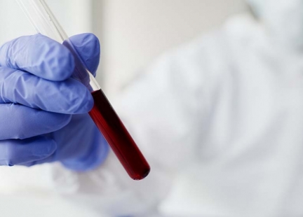 Jak interpretować wyniki morfologii krwi