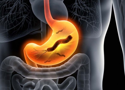 Helicobacter pylori – przebiegła bakteria
